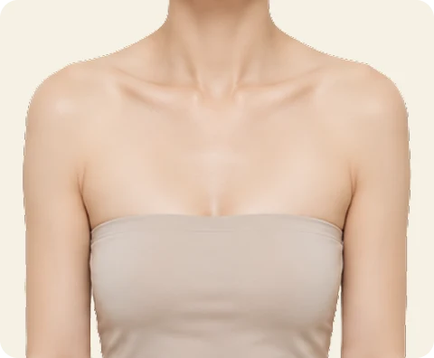 ボディボトックス — illustrative result at 2週目