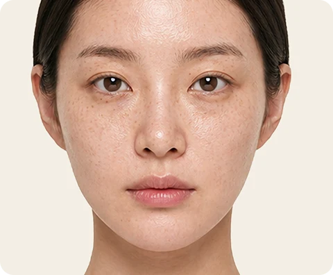 Genesis Toning — illustrative result at Sessions 1–2