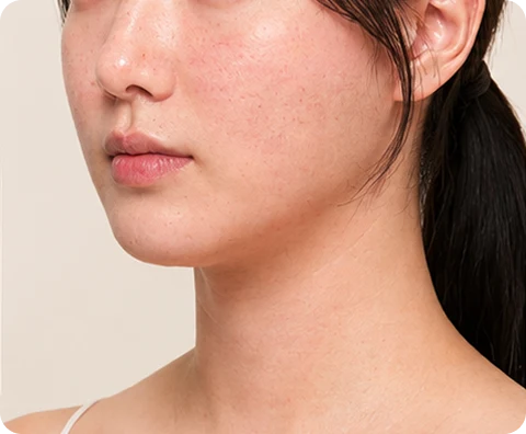 ONDA — illustrative result at 1〜2週間