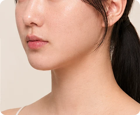 ONDA — illustrative result at 4〜8週間