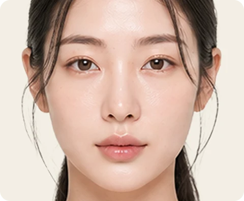 Pico Laser — illustrative result at 6 个月