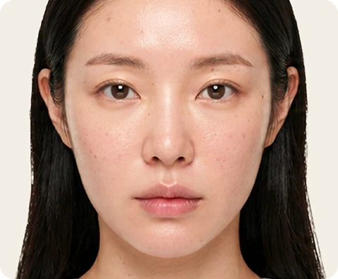 Potenza — illustrative result at 1か月
