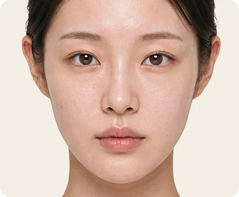 PRP療法 — illustrative result at 4〜8週目