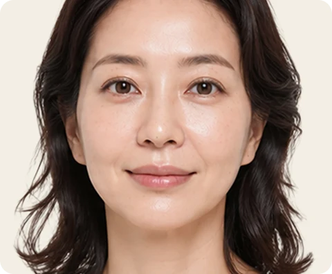 Ultherapy Prime — illustrative result at الشهر 12–18