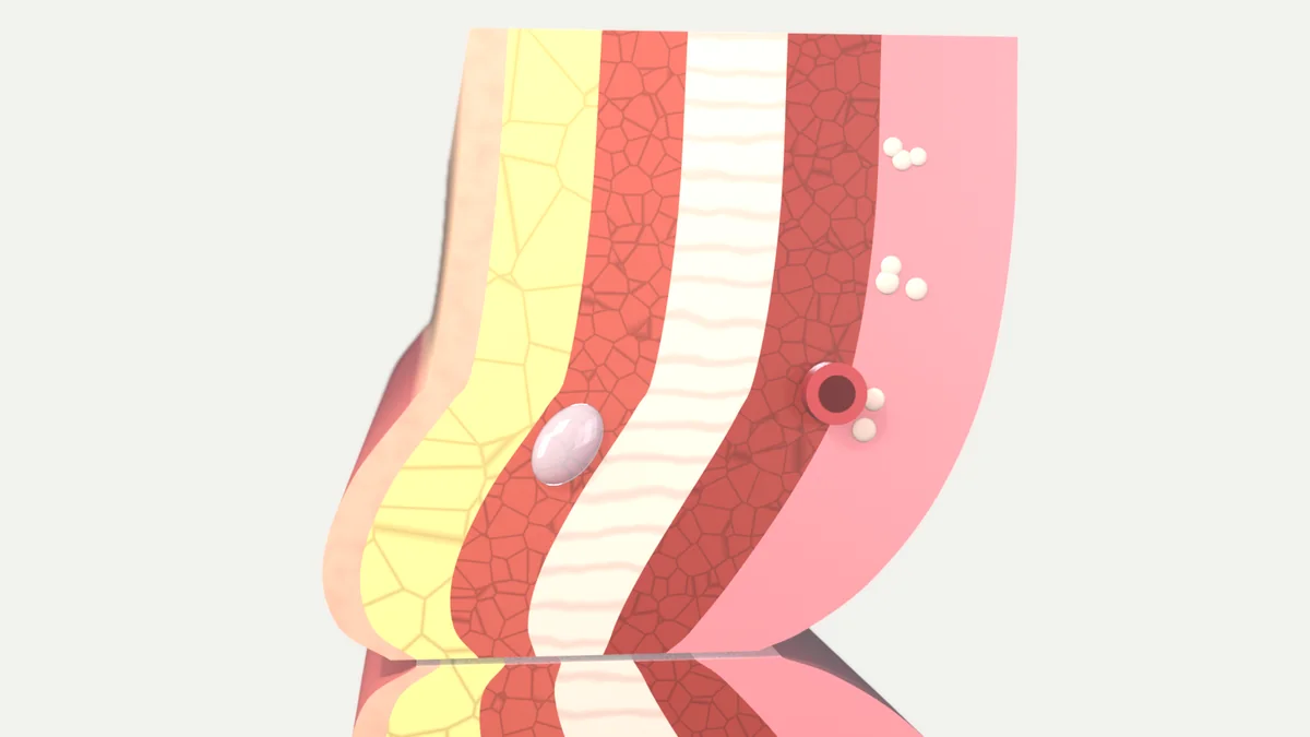 Close-up cross-section of the upper lip with its layers stacked from skin to inner mucosa and a clear gel deposit inside the muscle layer