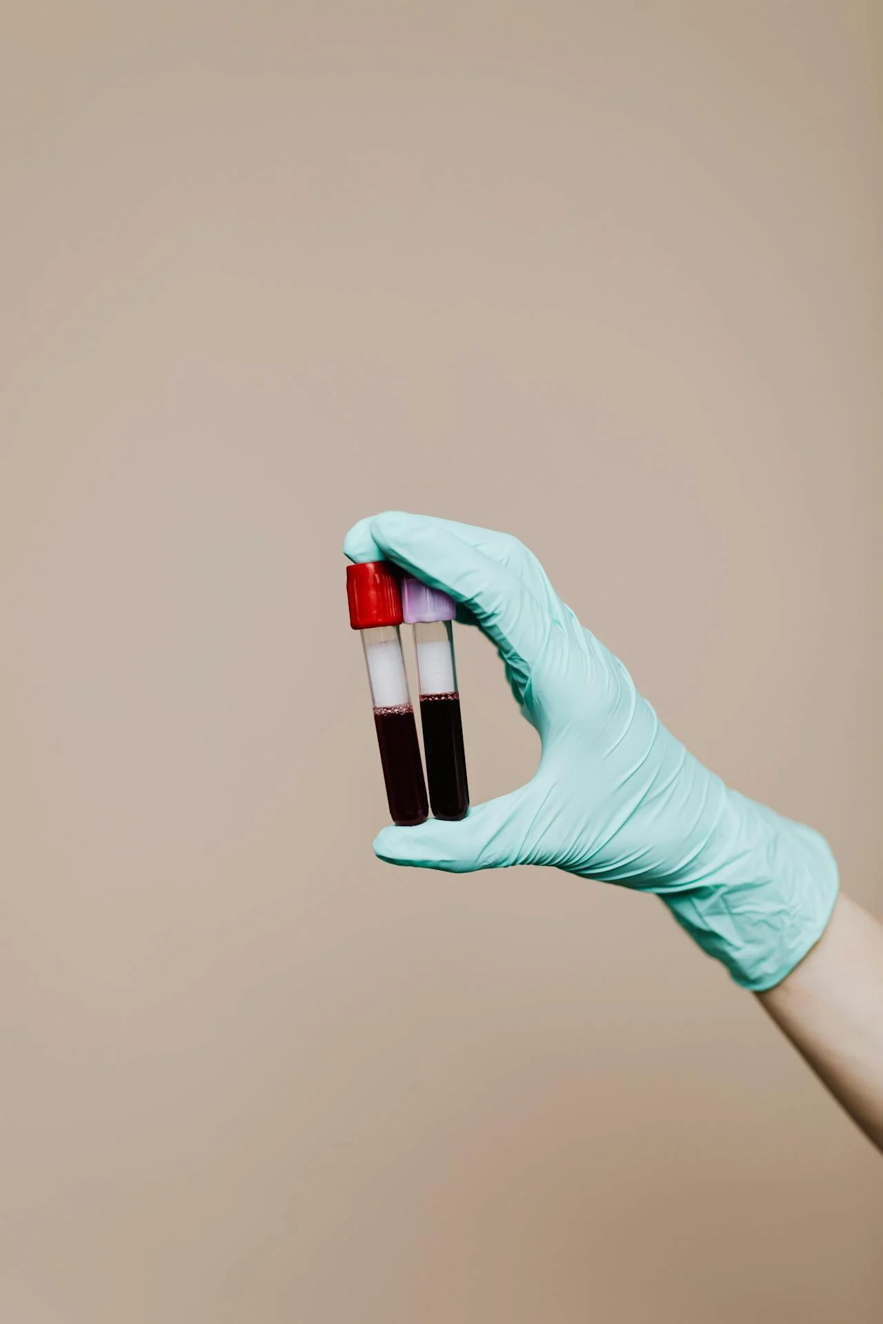 PRP & Stem Cell Therapy: The Science of Self-Regeneration