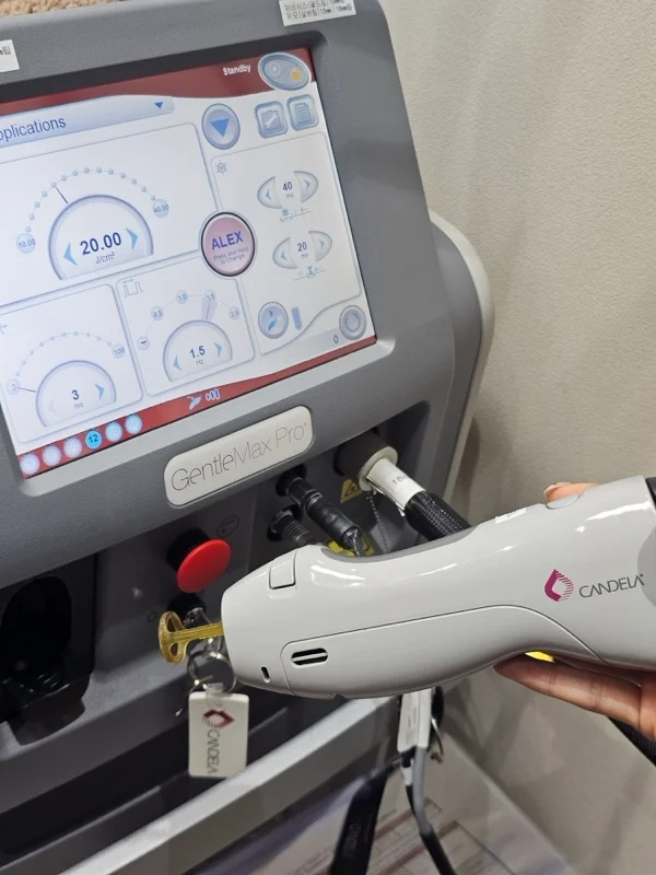 Candela GentleMax Pro dual-wavelength laser system