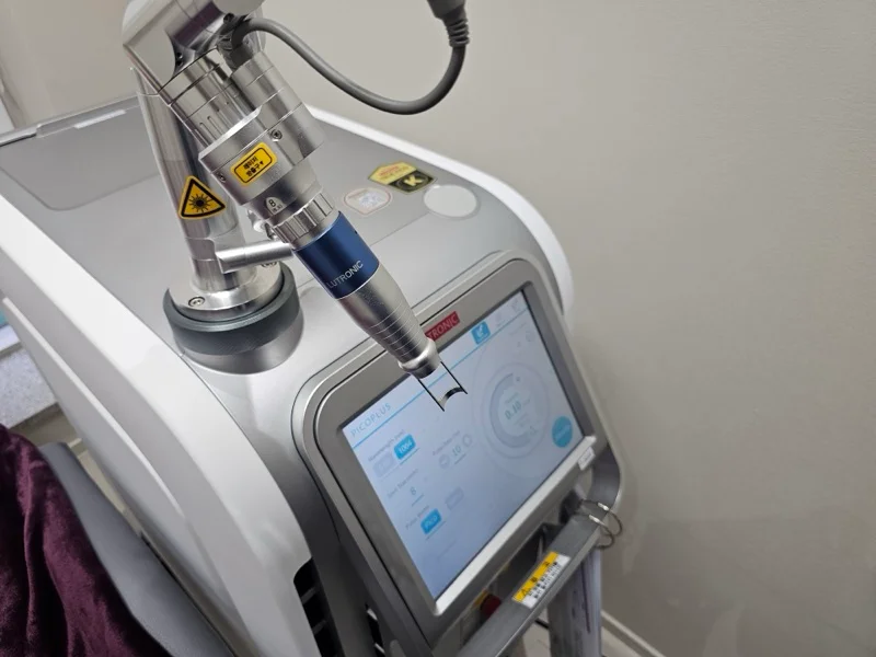 Pigmentation Treatment Seoul | Pico, Spectra & Genesis-Style Toning