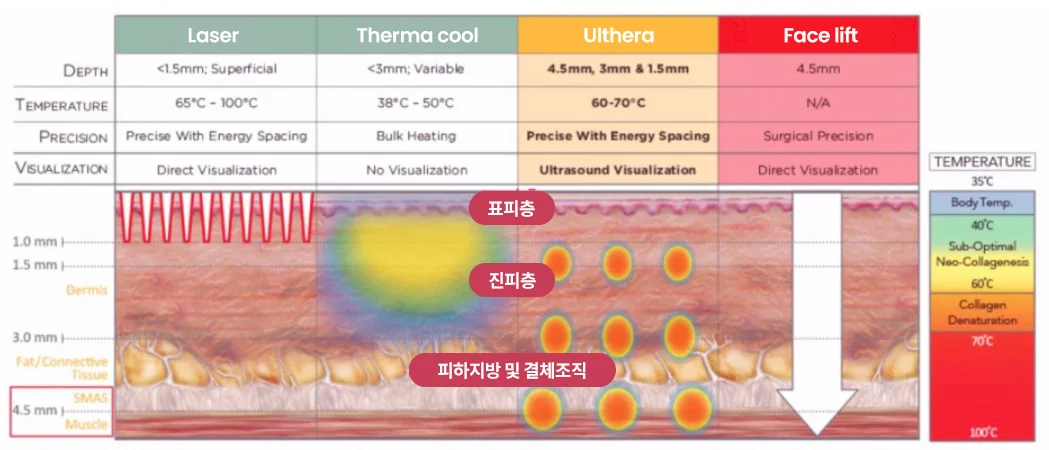 การเปรียบเทียบเทคโนโลยียกกระชับ Ultherapy, Thermage และเลเซอร์แบบละเอียด